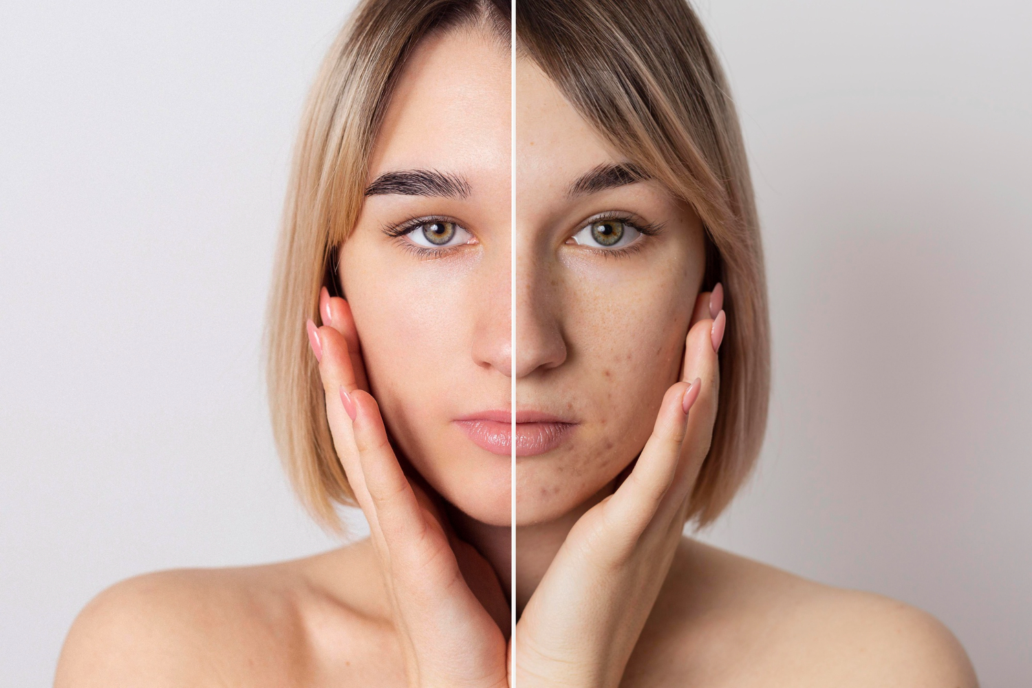 You are currently viewing Unlock Your Skin’s Potential: CBD Solutions for Acne and Wrinkles